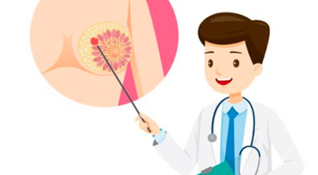 乳腺癌的早期征象有哪些？