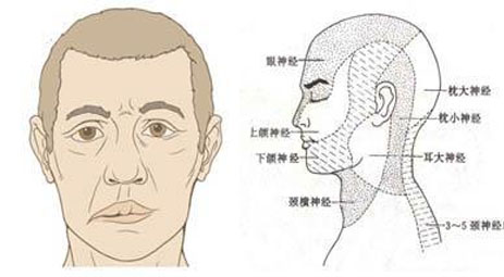警惕：头面部意外受伤很可能诱发面神经损伤