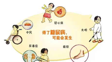 糖尿病的并发症有什么呢