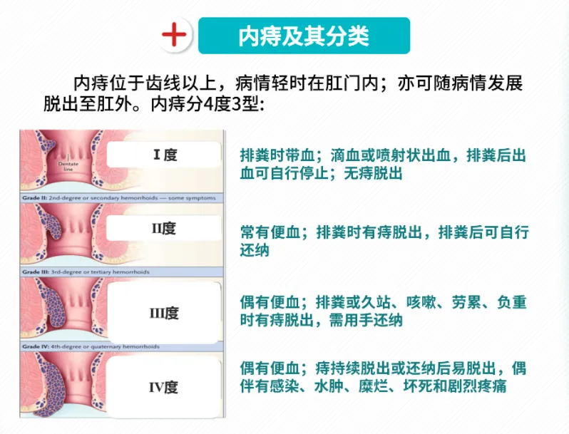 我院肛肠外科团队在贺向东教授的带领下，顺利完成多例肛肠手术